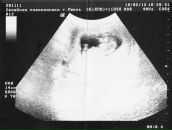 Фотография Путилова Антона